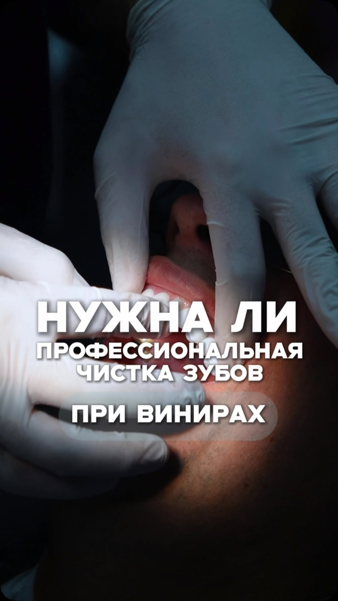 Пародонтология в Стоматология City